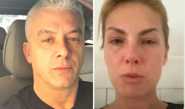 ana hickmann sofre agressão do marido